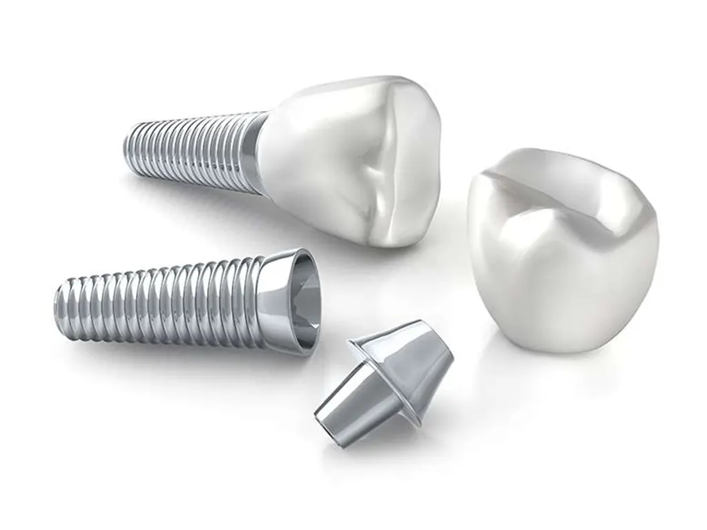 インプラント-美松デンタルオフィス