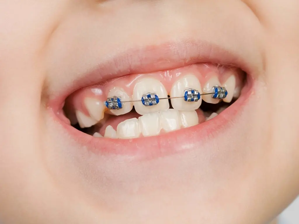 矯正歯科-美松デンタルオフィス